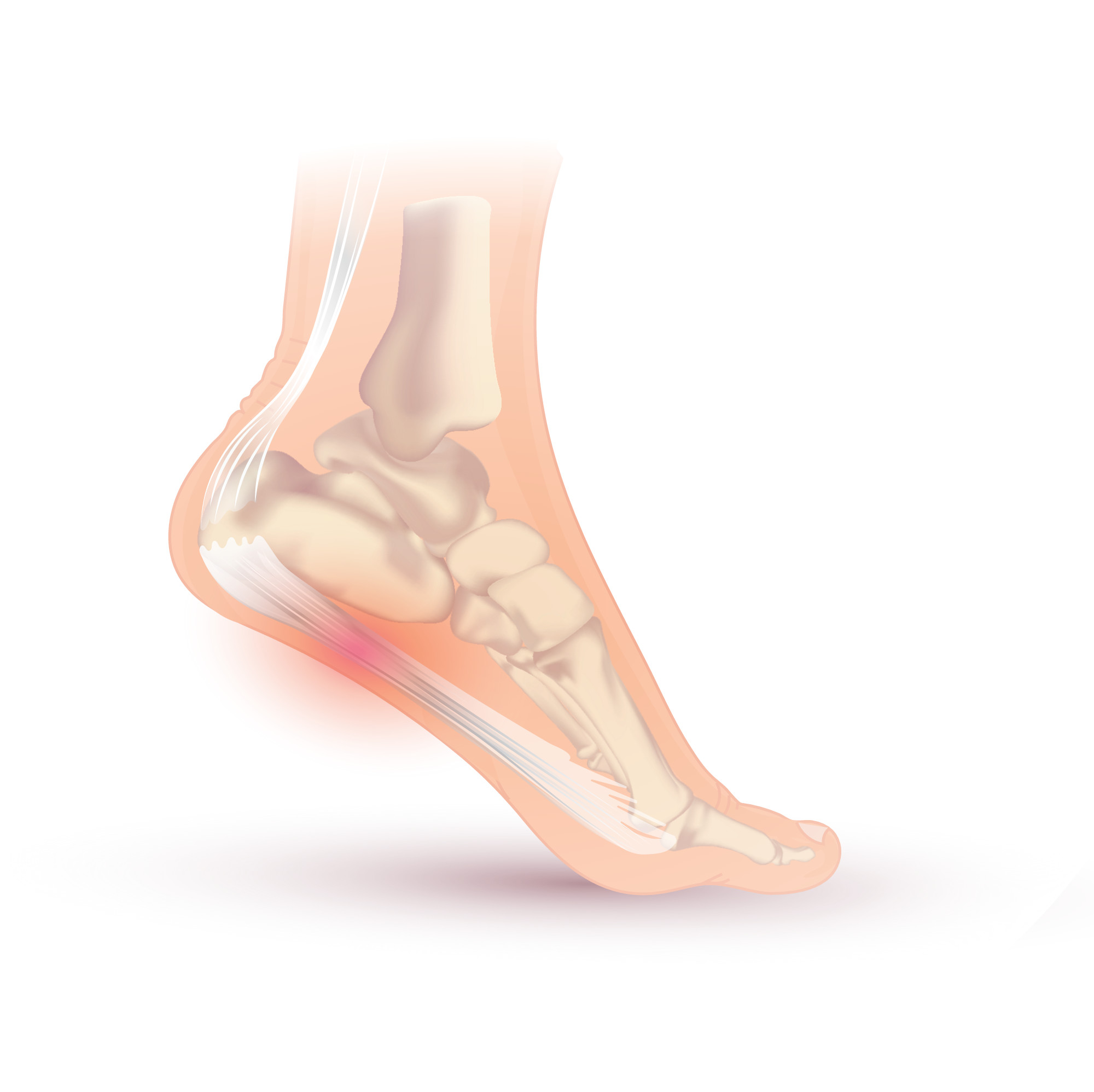 Plantar fasya ve ayak arkı anatomisini gösteren topuk ağrısı illüstrasyonu