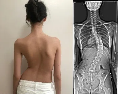 Postür analizi text neck ergonomi eğitimi Şişli